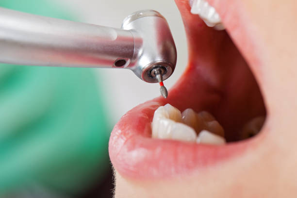 Best Emergency Denture Repair in Crystal Lake, CT